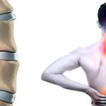 دیسک بین‌مهره‌ای | بهترین متخصص کایروپراکتیک اصفهان | دکتر مسعود اعتدالی