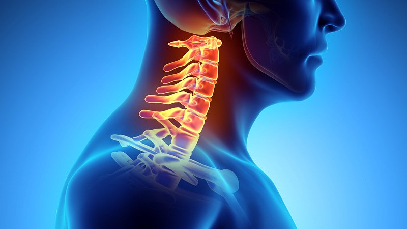 بررسی خطرات دیسک گردن | بهترین متخصص کایروپراکتیک