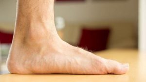 درمان کف پای صاف | بهترین متخصص کایروپراکتیک